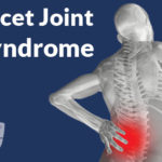 Facet Joint Syndrome