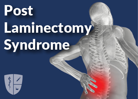 Post Laminectomy Syndrome