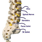Chronic Lower Back Pain