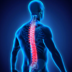 Peripheral Nerve Stimulation - Cahaba Pain and Spine Care